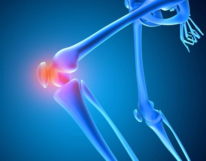 3D render of a medical image of a skeleton with knee bone highlighted