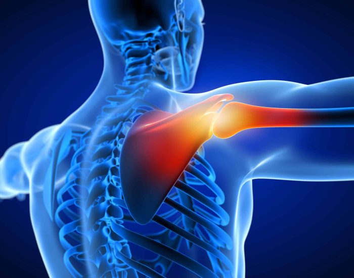 3d rendered medically accurate illustration of a man having a painful shoulder.