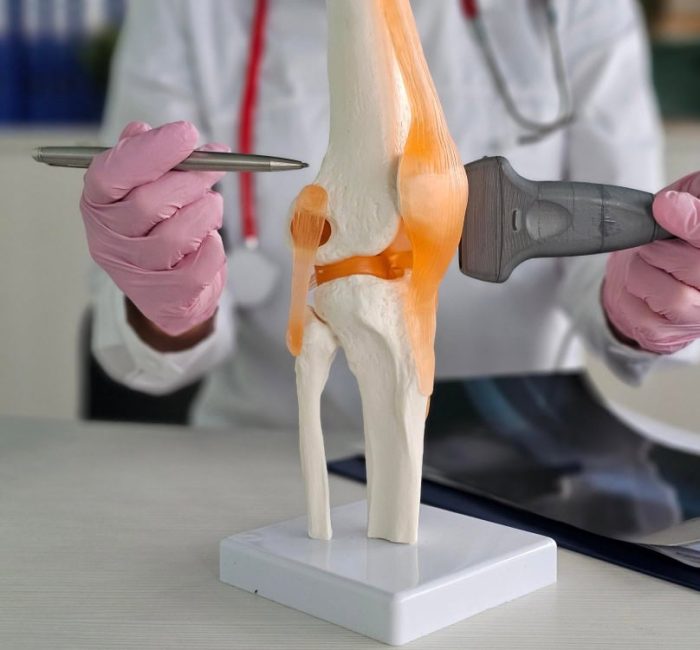 Knee surgery arthroscopy-2 04-03-2026 12_53_15_942