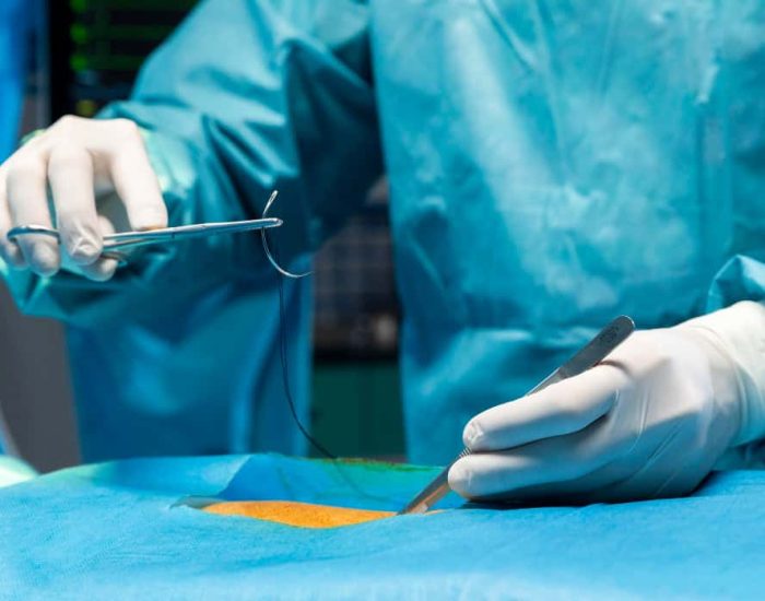 Knee surgery arthroscopy-4 04-03-2026 12_53_16_338